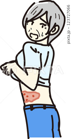 帯状疱疹イメージイラスト_腹部 帯状疱疹イメージイラスト_腹部 123727066