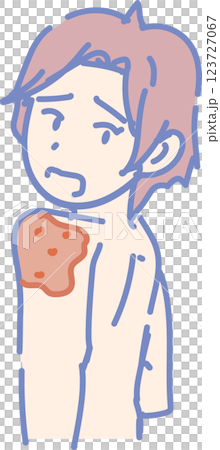 Shingles image_young man Shingles image_young man 123727067