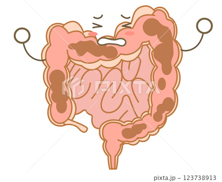 便秘で苦しむ大腸のキャラクターイラスト 123738913