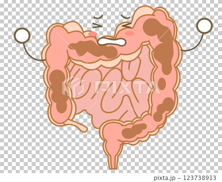 大腸便秘的字符說明 123738913