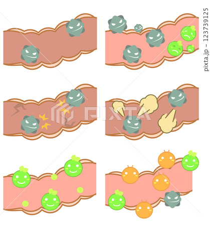 大腸内部の腸内細菌のイラストセット 123739125