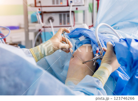 Arthroscope surgery. Orthopedic surgeons in teamwork in the operating room  123746266