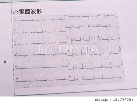 健康診断での結果判定と数値　血圧、メタボリック、血液、悪玉善玉コレステロール、ガンマGTPなど 123754588