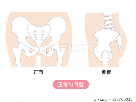 正常な骨盤の位置状態を表した図説イラスト 123769033