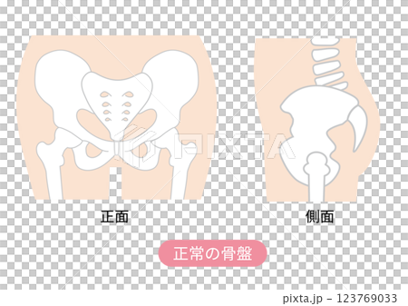 正常な骨盤の位置状態を表した図説イラスト 123769033