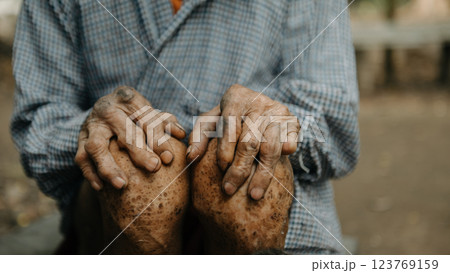 Close up of male wrinkled hands, old man is wearing  skin disease and anxiety Copy space. 123769159