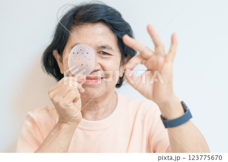 Elderly Woman with eye protective shield after eye surgery. Eye disease, Cataract,  Glaucoma, Age Related Macular Degeneration, Diabetic Retinopathy, Vitreous, Lasik, World Glaucoma day and health 123775670