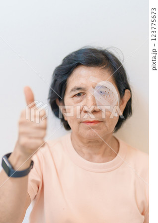Elderly Woman with eye protective shield after eye surgery. Eye disease, Cataract,  Glaucoma, Age Related Macular Degeneration, Diabetic Retinopathy, Vitreous, Lasik, World Glaucoma day and health 123775673