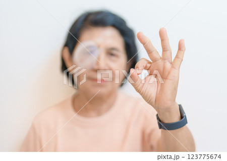 Elderly Woman with eye protective shield after eye surgery. Eye disease, Cataract,  Glaucoma, Age Related Macular Degeneration, Diabetic Retinopathy, Vitreous, Lasik, World Glaucoma day and health 123775674