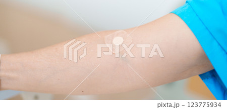 Elderly asian Patient Woman with medical patch plaster after blood test in hospital. Diagnose, illness, treatment, Insurance, Healthcare, medical Examination, Blood donation and World Blood Donor Day 123775934