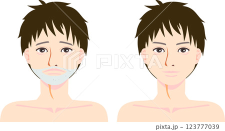 ヒゲ脱毛の男性 123777039