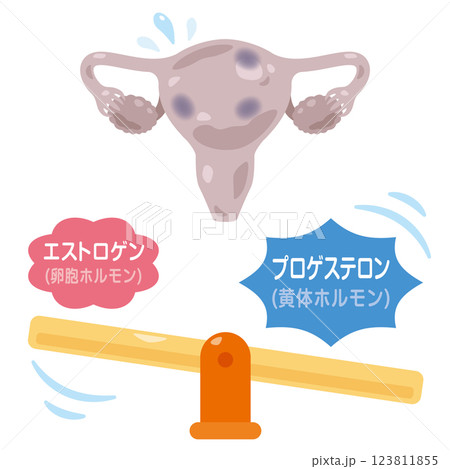 ホルモンバランスが崩れた子宮のイラスト 123811855