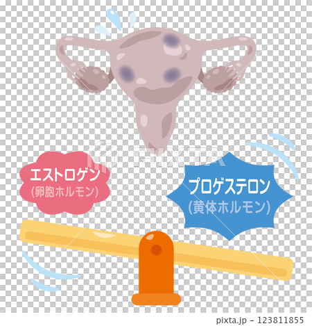 ホルモンバランスが崩れた子宮のイラスト 123811855