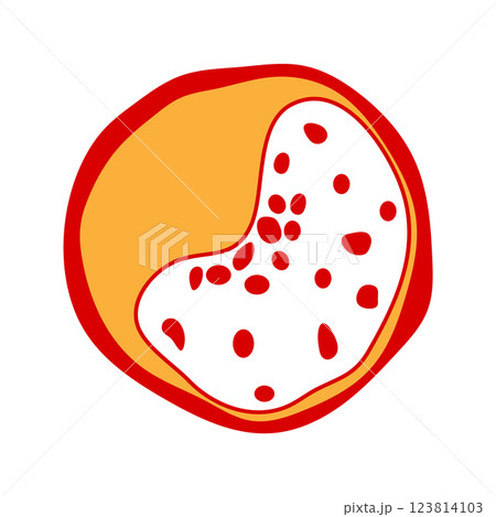 vector of cholesterol plaque 123814103