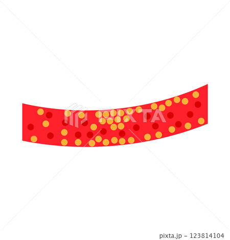 vector of cholesterol plaque 123814104