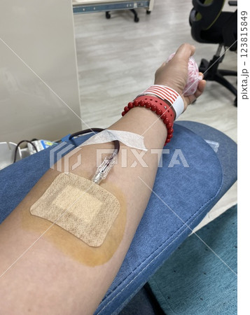 Blood Donation Process: A Woman Arm with a Needle Drawing Blood Blood Donation Process: A Woman Arm with a Needle Drawing Blood 123815849