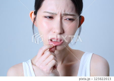 口内炎悩む女性イメージ 123822013