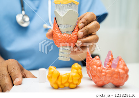 Hyperthyroidism, Overactive Thyroid, Thyroid Lymphoma, Asian doctor with thyroid gland human anatomy model in hospital. Hyperthyroidism, Overactive Thyroid, Thyroid Lymphoma, Asian doctor with thyroid gland human anatomy model in hospital. 123829110