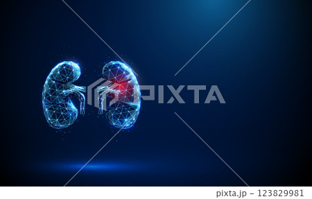 Abstract blue kidneys with red spot. Kidneys deseases, medical treatment and pharmacy concept Low poly style Abstract blue kidneys with red spot. Kidneys deseases, medical treatment and pharmacy concept Low poly style 123829981