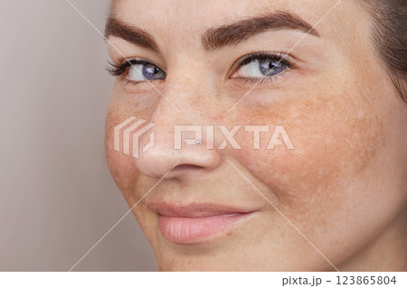 Close up caucasian woman's face with freckles or age spots. Age spots on the face Close up caucasian woman's face with freckles or age spots. Age spots on the face 123865804