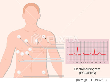 An electrocardiogram . An electrocardiogram . 123932395
