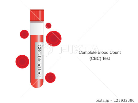 Complete blood count CBC is a blood test. 123932396