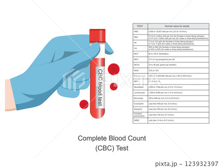 Complete blood count is blood tests. 123932397
