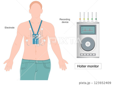 A Holter monitor heart monitor A Holter monitor heart monitor 123932409