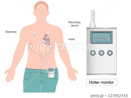 A Holter monitor heart monitor A Holter monitor heart monitor 123932410