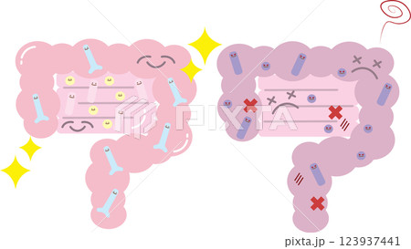 善玉菌が多く健康で綺麗な腸と悪玉菌が多く不健康な腸の比較イラスト 123937441