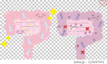 A comparison illustration of a healthy, clean intestine with many good bacteria and an unhealthy intestine with many bad bacteria 123937441