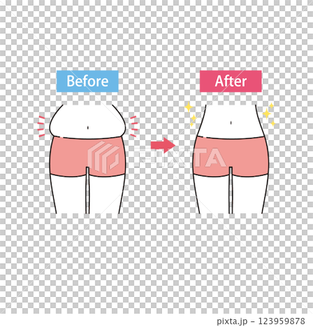 Before and after of a bulging belly 123959878