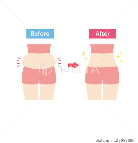 ぽっこりお腹のビフォーアフター 123959880