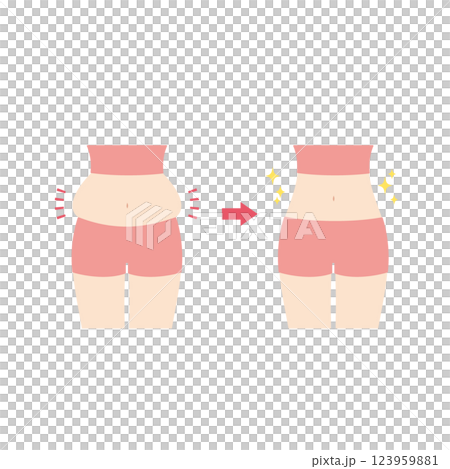 腹部隆起前後 123959881