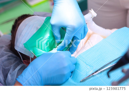 Treatment of baby teeth. Child is under anesthesia during dental treatment. Photo during the operation. Treatment of baby teeth. Child is under anesthesia during dental treatment. Photo during the operation. 123981775