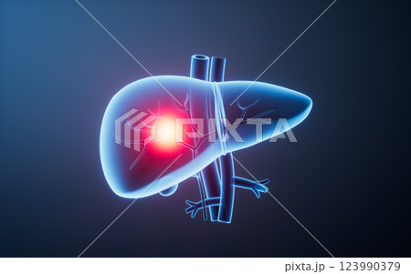 立体 3次元 3D 123990379