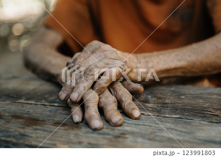 Close up of male wrinkled hands, old man is wearing  skin disease and anxiety Copy space. 123991803