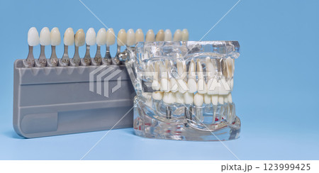 dental shade guide next to a transparent jaw model with tooth implants, used for color matching in dentistry. 123999425