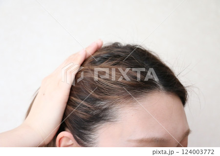 おでこの薄毛を気にする女性 おでこの薄毛を気にする女性 124003772