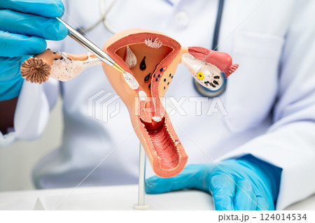 Uterus, doctor holding human anatomy model for study diagnosis and treatment in hospital. 124014534