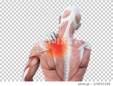 肩こりで肩を押さえる筋肉解剖図の男性の3Dイラスト 上半身後ろ姿 (赤い痛みのイメージ) 124031298