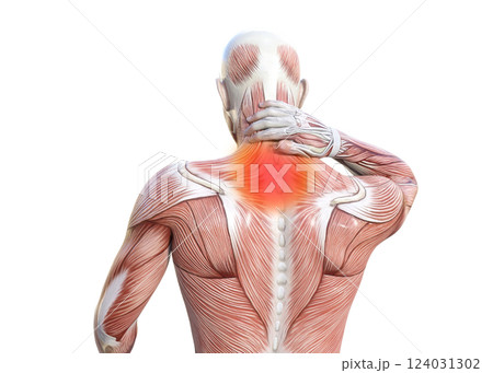 首こりで首を押さえる筋肉解剖図の男性の3Dイラスト 上半身後ろ姿 (赤い痛みのイメージ) 124031302