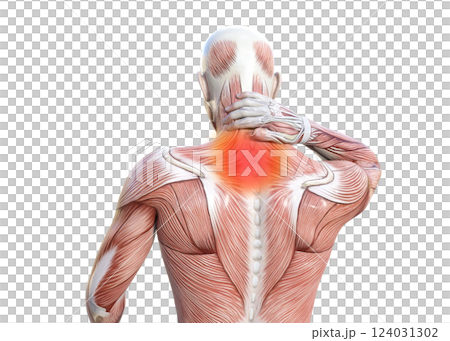 首こりで首を押さえる筋肉解剖図の男性の3Dイラスト 上半身後ろ姿 (赤い痛みのイメージ) 124031302