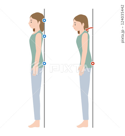 理想的な良い姿勢で健康な女性と、姿勢が悪く猫背で立つ女性の全身のイラストのセット 理想的な良い姿勢で健康な女性と、姿勢が悪く猫背で立つ女性の全身のイラストのセット 124035442