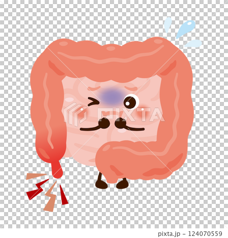 Character illustration of an intestine with appendicitis 124070559