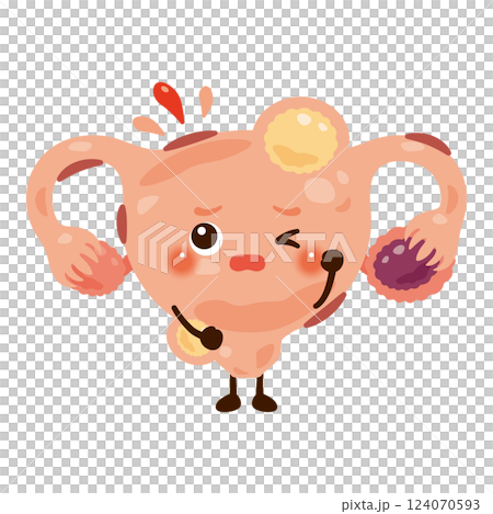 子宮内膜症や子宮筋腫ができた子宮のキャラクターイラスト 124070593