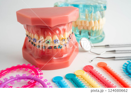 Cigarette in teeth model isolated on white background, damage the health of your teeth, No smoking. 124080662