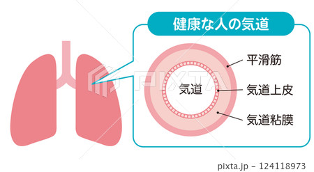 健康な人の気道 124118973