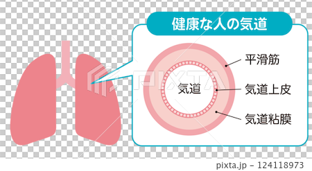 健康な人の気道 124118973