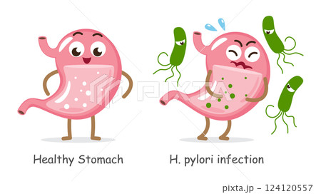 Healthy stomach and Helicobacter pylori infected stomach . Cute medical cartoon characters . White isolated background . Vector . 124120557
